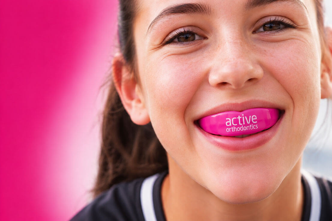 Custom orthodontic mouthguards manufactured by UK dental laboratory for sports and protection